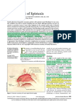 Management of Epistaxis