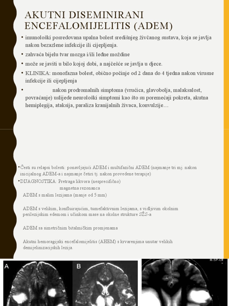 Adem | PDF