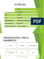 Caso Clinico Audicion