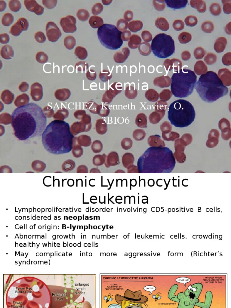 Chronic Lymphocytic Leukemia Overview | PDF | Politics