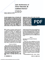 Lnfections : M Ycobacterium Tuberculosis, M Kansasii, M Intracellularis