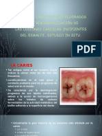 Efecto de Los Sistemas Fluorados en La Remineralización