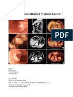 Neo Gastric