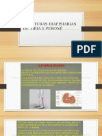 Traumato Fracturas Tibia