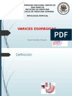 Varices Esofágicas