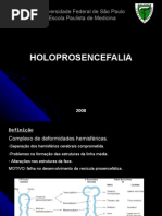 Holoprosencefalia2008