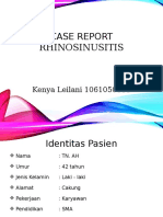 case report rhino sinusitis