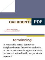 Overdenture