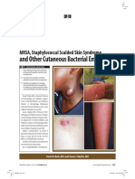 And Other Cutaneous Bacterial Emergencies: MRSA, Staphylococcal Scalded Skin Syndrome