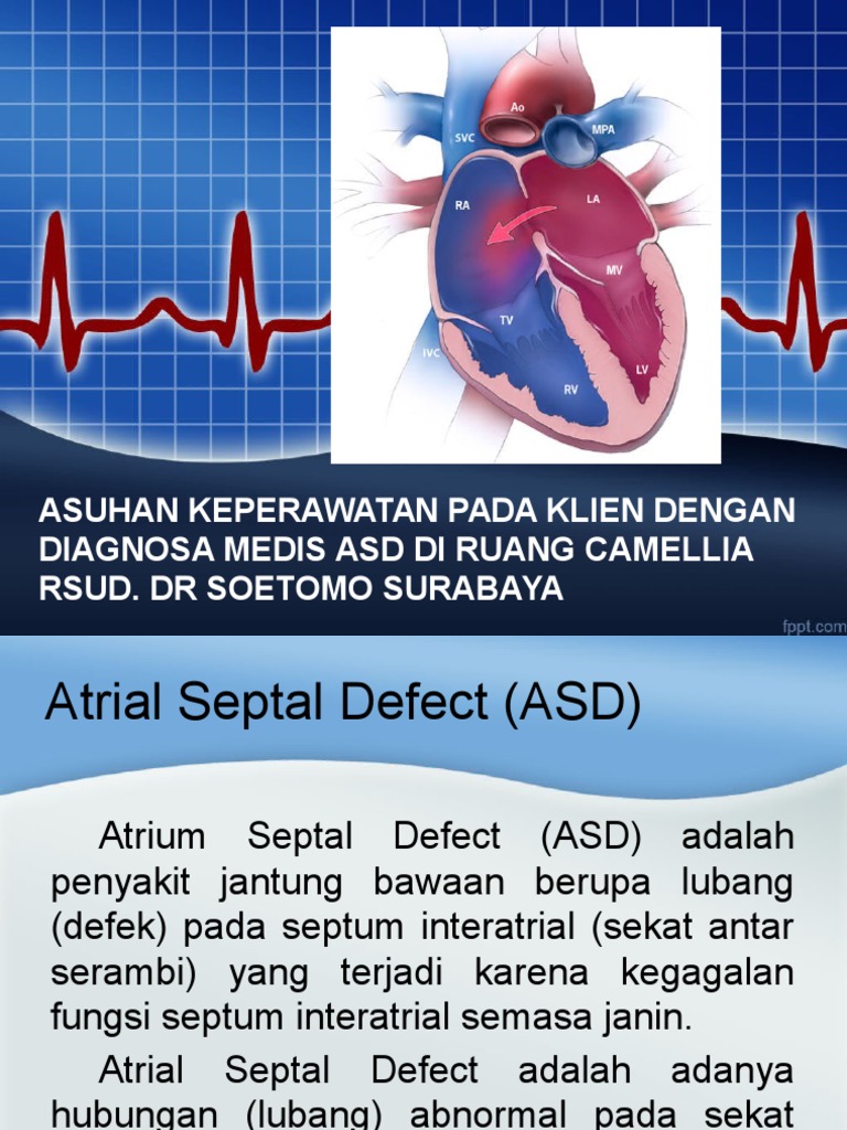 Asd Seminar | PDF | Sains & Matematika
