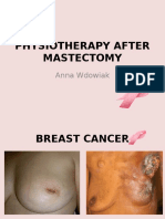 Physiotherapy for Breast Cancer Recovery