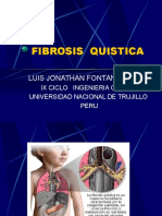 Fibrosis Quistica Fq