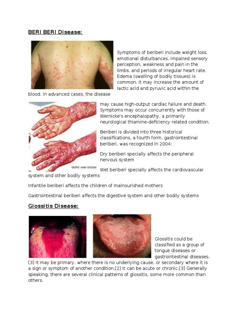 BERI BERI Disease | PDF | Anemia | Clinical Medicine