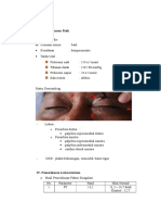 xanthelasma