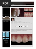 Http Www.styleitaliano.org Composites in the Aesthetic Zone Yes We Can