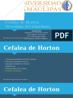 14. CEFALEA- Cefalea de Horton. Tic Doloroso (Neuralgia) Del Trigemino