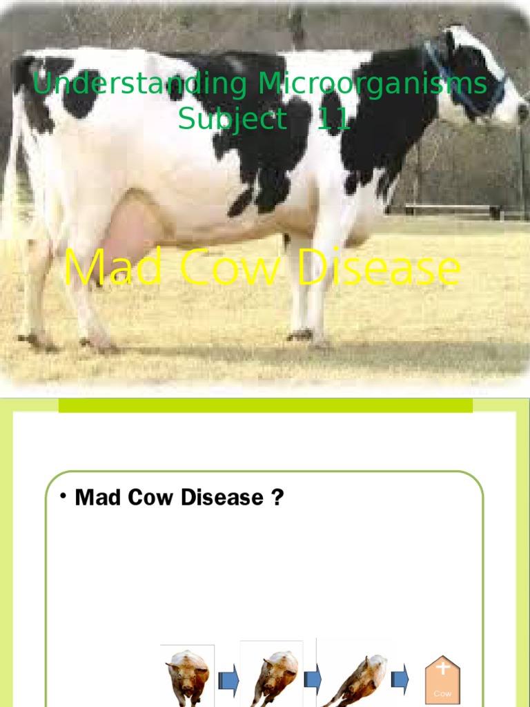 Mad Cow Disease Neurodegenerative Disorders Clinical Pathology