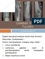 GBR Bimb Tumor Tulang