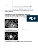 CT Scan Saluran Kemih