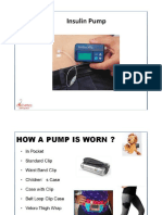 Insulin Pump