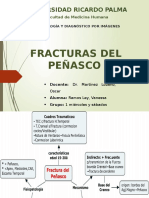 Fracturas Peñasco