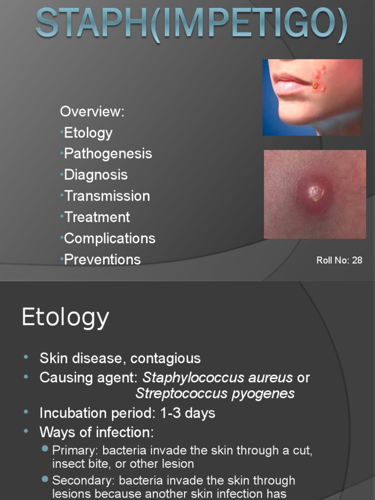 Impetigo Immunology Public Health