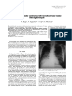 Bronchioloalveolar Carcinoma With Bronchorrhoea Treated