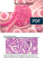 Glomerulopathies