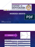 Mordida Abierta