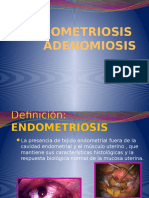 2 . Endometriosis