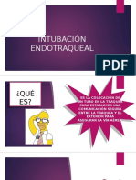 Intubación Endotraqueal