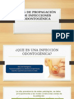 Infecciones odontogénicas: vías propagación y complicaciones