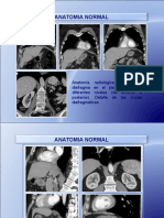 Anatomia Normal y Patologa Herniaria