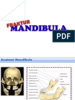 Fraktur Mandibula Fix