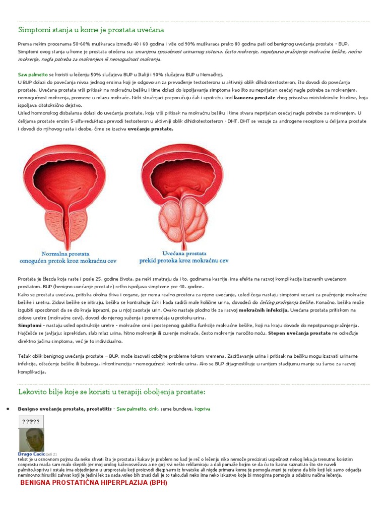 Lečenje Prostate | PDF