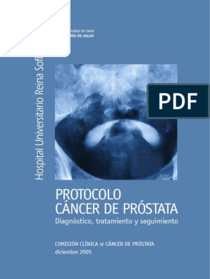 comision de prostatita