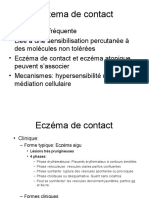 Eczema de Contact