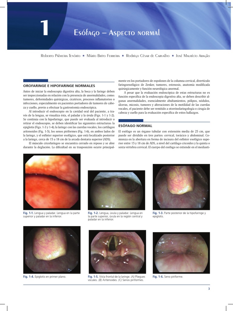 Aspecto Normal del Esófago en Endoscopia | PDF | Estómago | Esófago