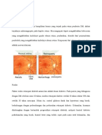 Retinopati Diabetik