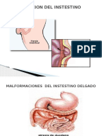 Malformacion Del Instestino Delgado - Dene