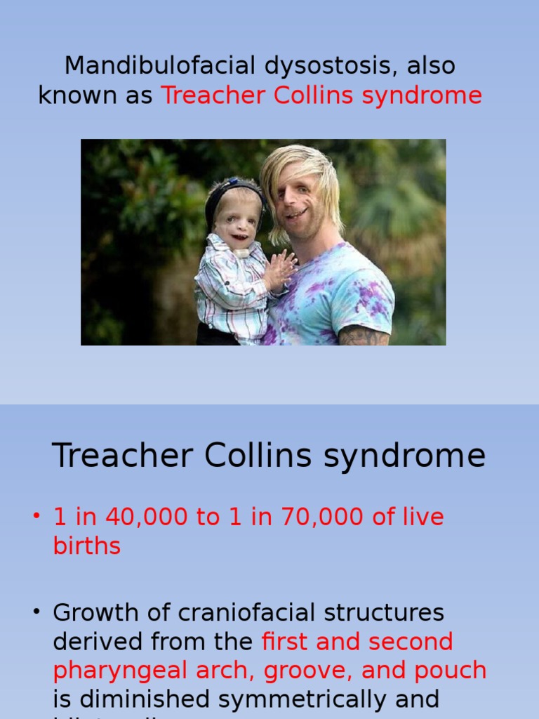 Treacher Collins Syndrome Overview | PDF | Ear | Human Head And Neck