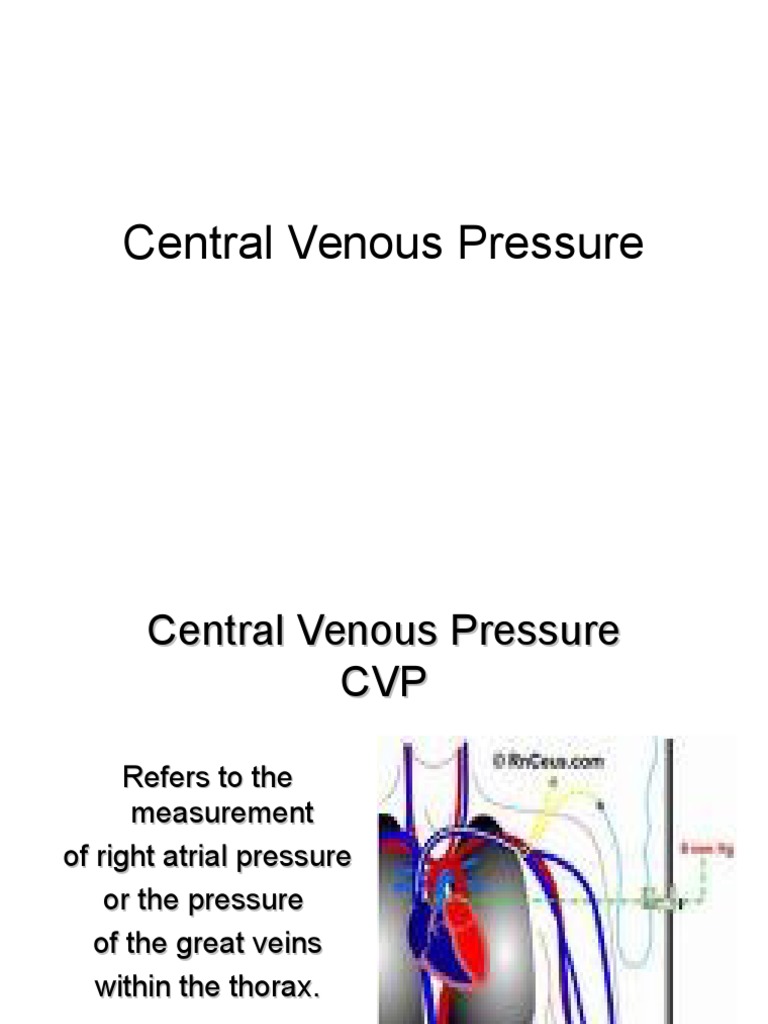 Central Venous Pressure PDF Intravenous Therapy Vein
