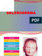 Scleroderma.pptx