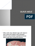 Ulkus Mole