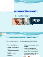 kb-iud-implant-dll.ppt