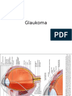 Glaukoma