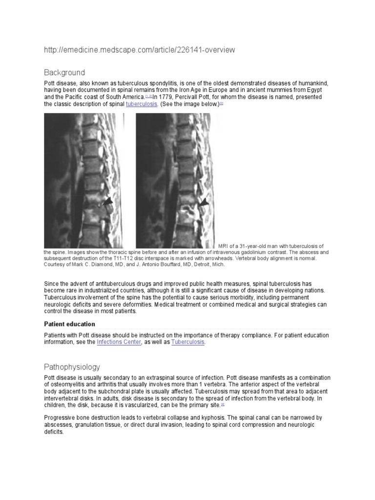 Pott's Disease Medscape PDF Vertebral Column Pathology