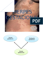 Herpes Gestacional