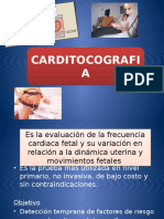 Carditocografia