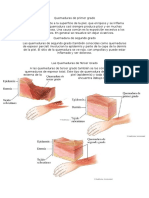 Quemaduras de Primer Grado